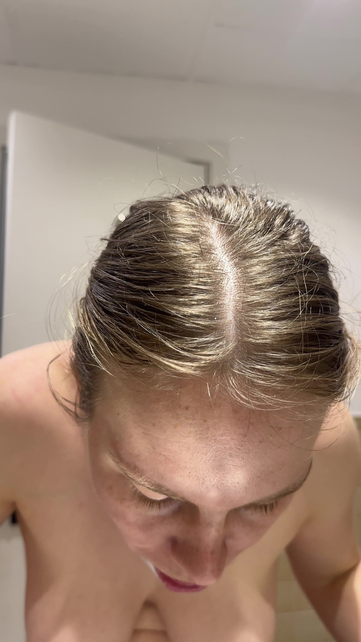SweetLucy96: Tiener met beugel poetst tanden