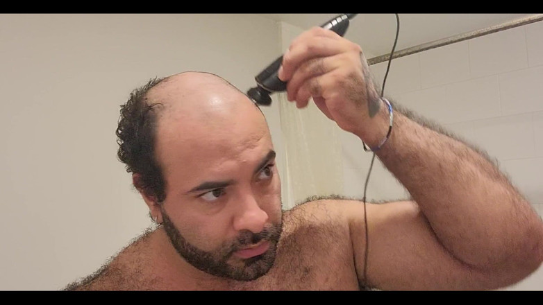 Lobo: I Finally Got Rid of the Head Hair