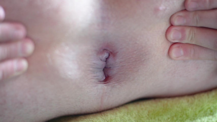 Marcus Pollack Gay: Asshole Closeup