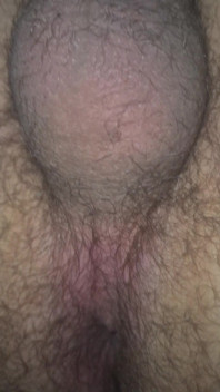Little Wank