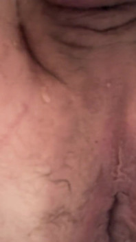 Anal Gape
