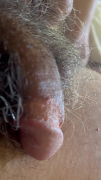 My Penis