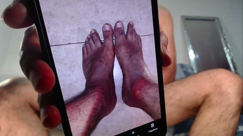 Tommhot: Man Stripping Live and Showing His Uncircumcised Penis