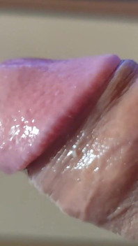 거대한 머리를 가진 이상한 덩어리 같은 음경.
