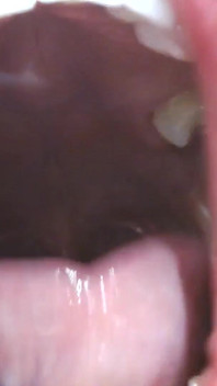 Uvula di denti dentro la mia bocca grande lingua