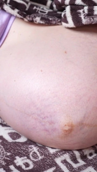 Schwangere Bauchbewegungen & Bauchklatschen Letzten Monat Schwanger
