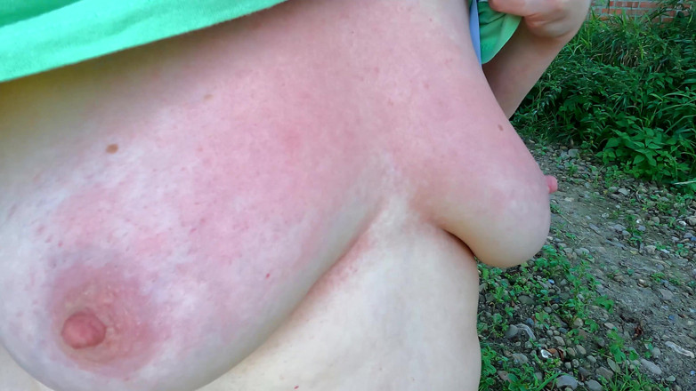Bouncy Tits Action: In Addition to the Nettles, the Tits Beaten Red