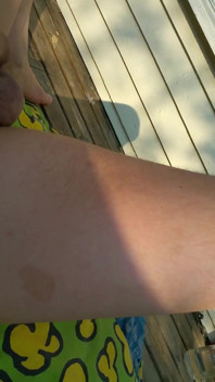 Tanning My Dick Outdoors