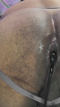 Gaping My Ass