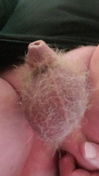 M Tinydick