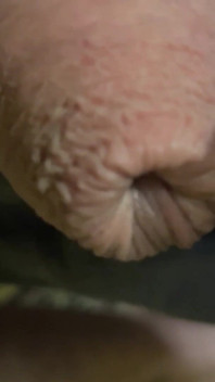 Party Dick