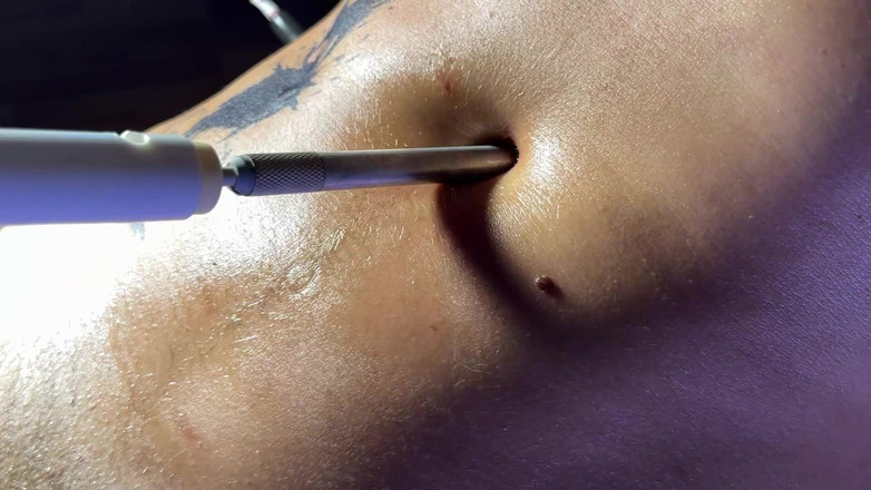 Navel fans: Được khoan bởi một cái máy đụ
