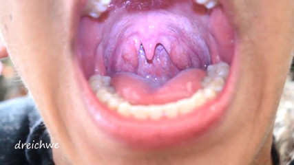 Dreichwe: Uvula feticcio bocca