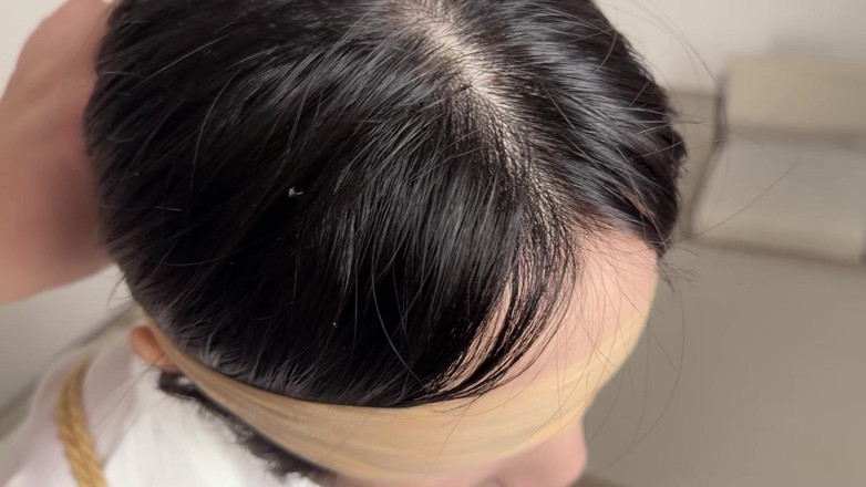 Yanmoushengyi: 일본식 안티샤시 침 수집