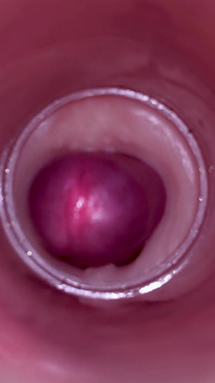 Inseminazione femminile - la telecamera interna cattura un'eiaculazione maschile profonda
