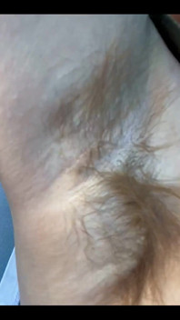 What Do You Think of My Hairy Armpits?