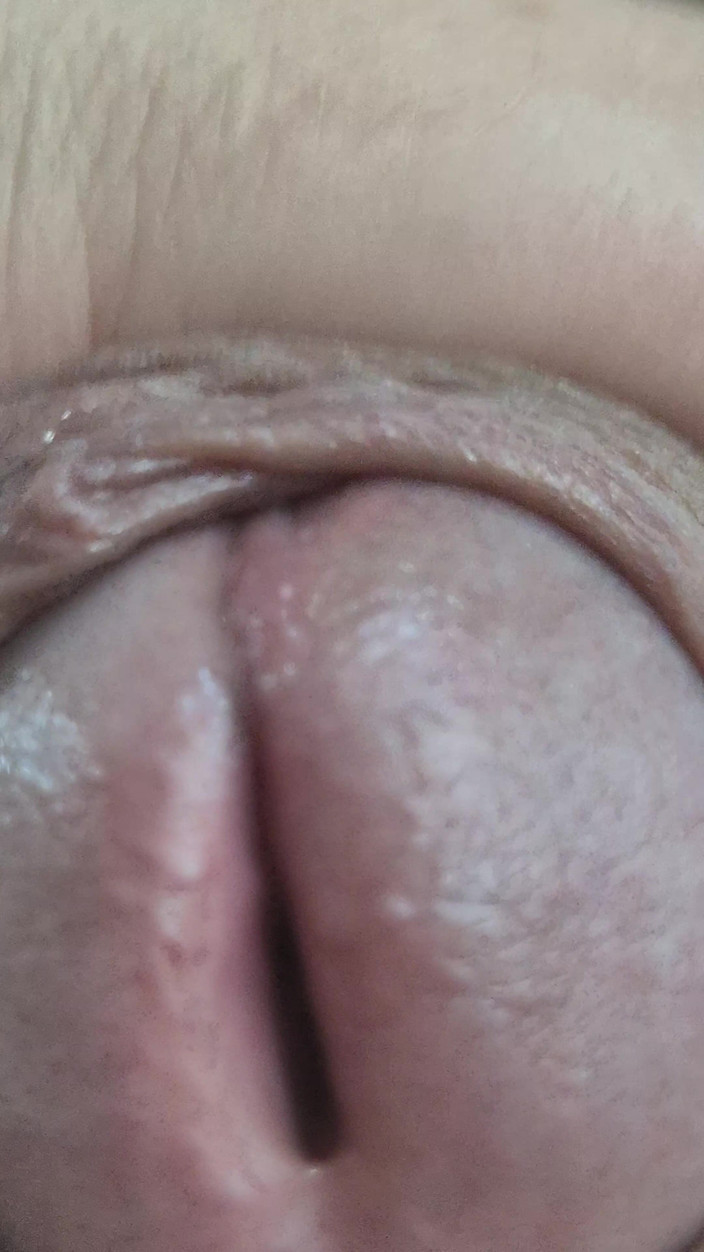 Lkdick8: Kepala kontolku dientot super besar