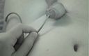 Wibblewang: Catheter Removal