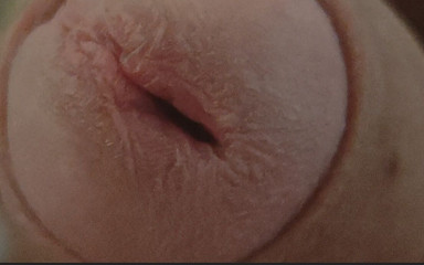 DaddyDoted: Amazing Closeup of the Widened Hole!!