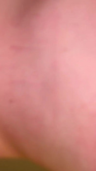 Tổng hợp hậu quả