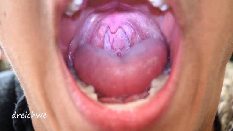 Dreichwe: Mulut fetish Uvula