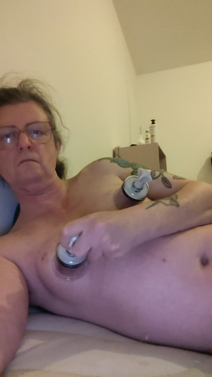 Alexia_mtf: 나를 자극하는 상처