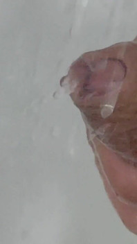 포피에 강한 물이 들어가면 사정 전두가 자극됩니다.