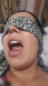 Mordida de dedo
