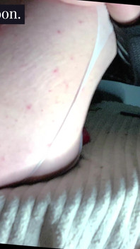 Anale spalancando a pelle grezzi giocattoli xxl