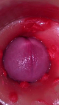 질에 카메라, 자궁 경부 POV, 질싸
