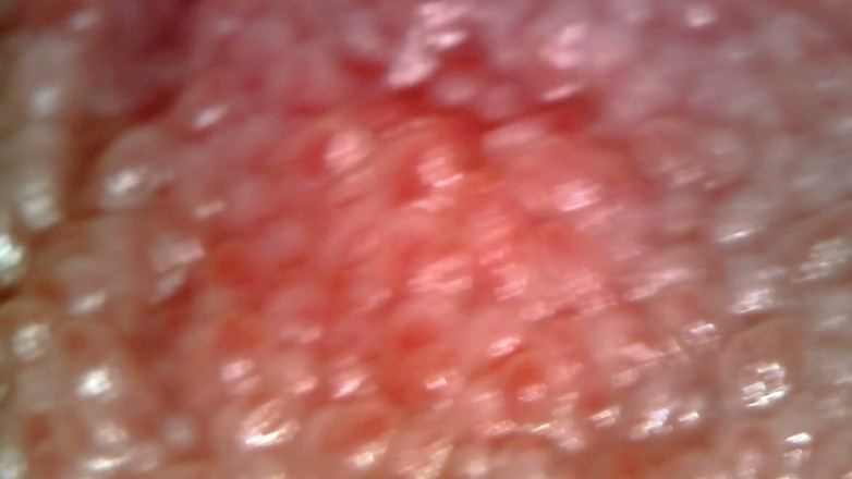 Nicoletta Embassi: Medisch Endoscoop Mondeling Onderzoek: Gummy Kauwen, Extreme Tanden &amp; Tongmacro
