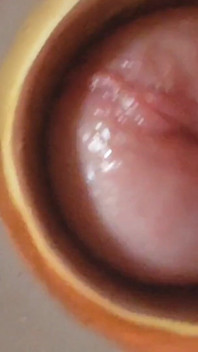 Boy Close up Tight Uncircumcised Glans Excited