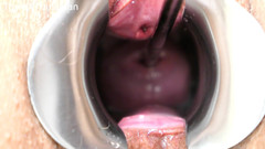 TripleXTransMan: Je pénètre mon col de l’utérus !