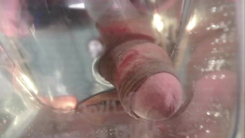 Tommhot: Pik ondergedompeld in urine