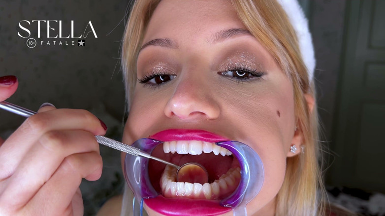 Stellafatale: ตรวจฟันของ Retractor ปาก