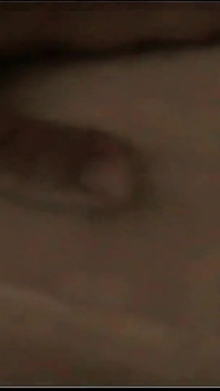 Hi8 tape ssbbw điều trị