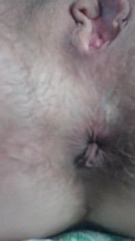 Prolapse Play Close up