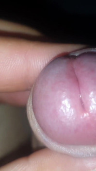 Dick Erection