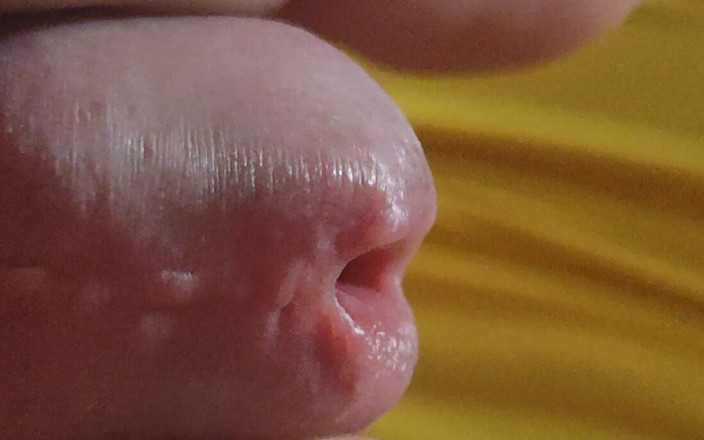 Straight Daddy Club: Scarred Frenulum Causes Glans Erection!