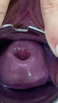 Glass Dildo Cervix Penetration