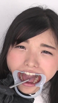 [teeth Observation] Natural Teeth but Potential Cavities Found!! Beauty Winces When Her Teeth Are Tapped - Suzu Shiratori