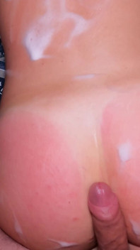 My Stepsister Got Sunburned and Asked for Help!