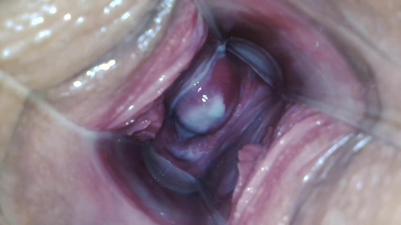 JANA studios: Endoskop dalam pepek saya