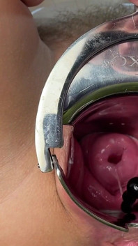 Crazywifeslut Cervix and Peehole Play