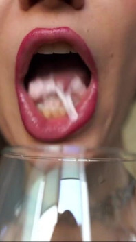 Drool Collector