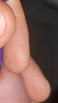 Penis Probing with Application of Fortifying Serum.