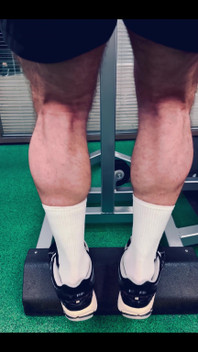 My Legs