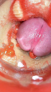 Telecamera in Anale Cervix POV, Piccolo Cornuto Da 'coppia' Gigante, Sborra in Anale E Creampie - Asmr