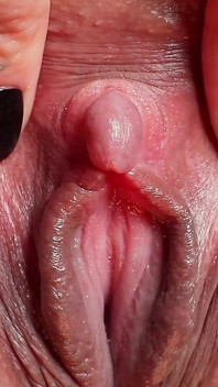 Clítoris HD 3