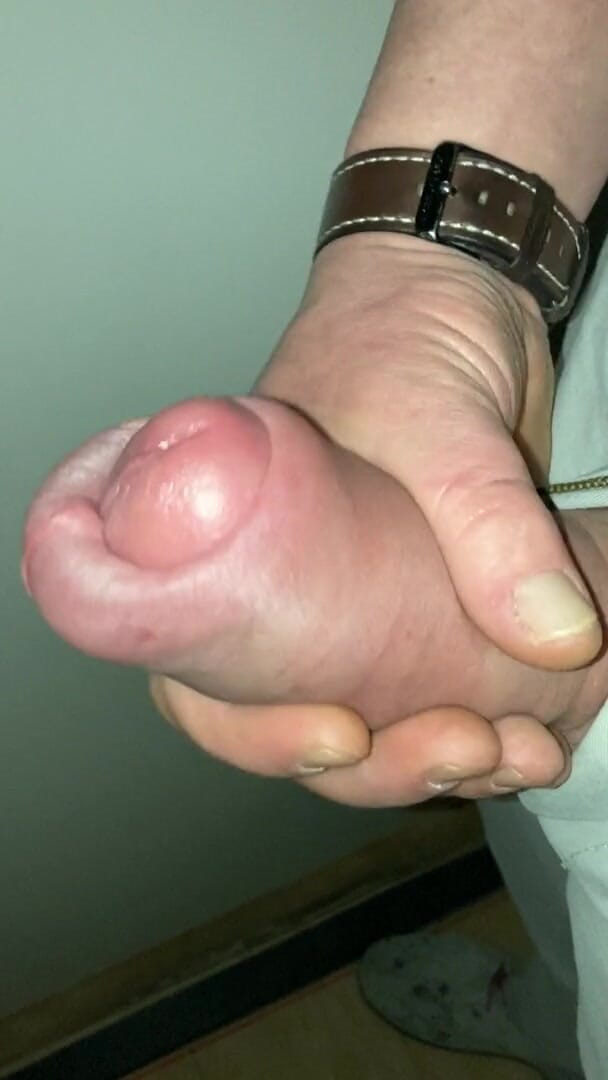 Huge Cock Pumped Foreskin Jerk off (Foreskin1985)